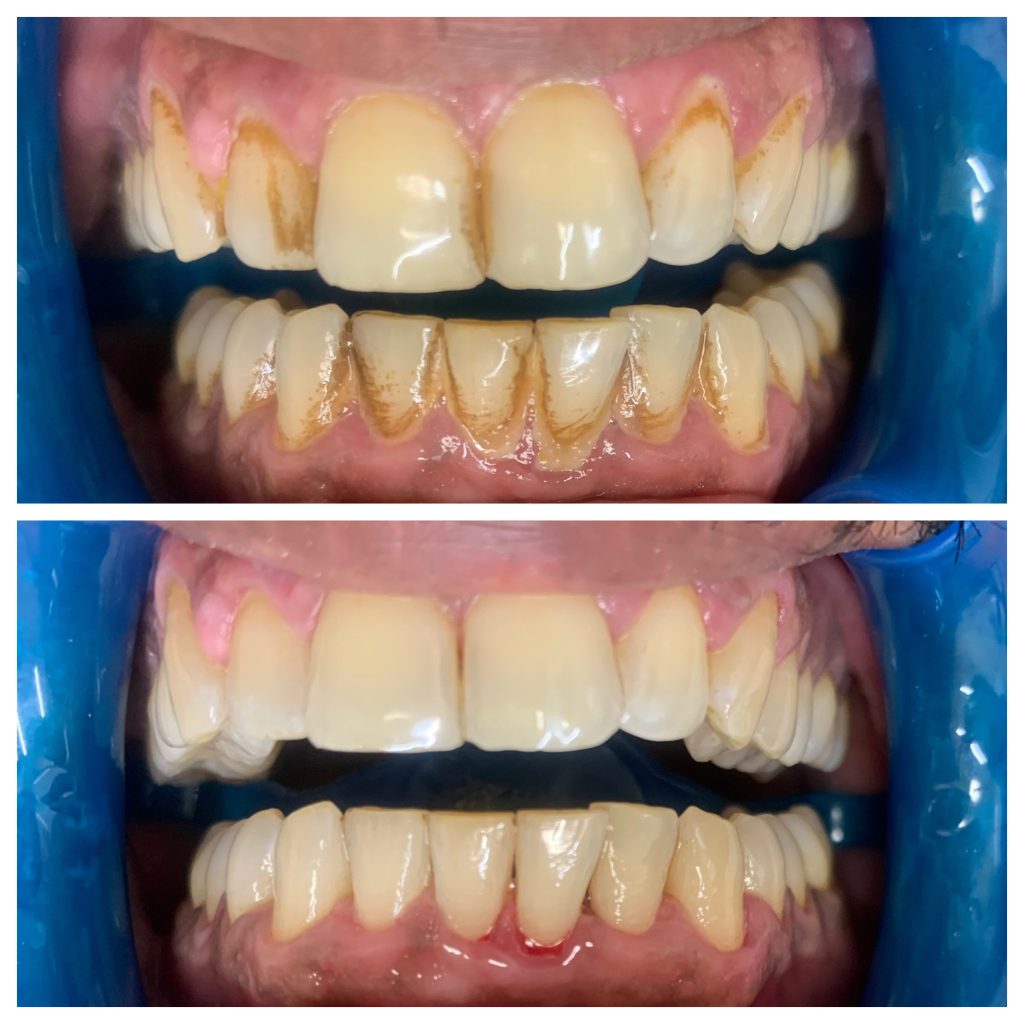 dental hygienist near me, North London