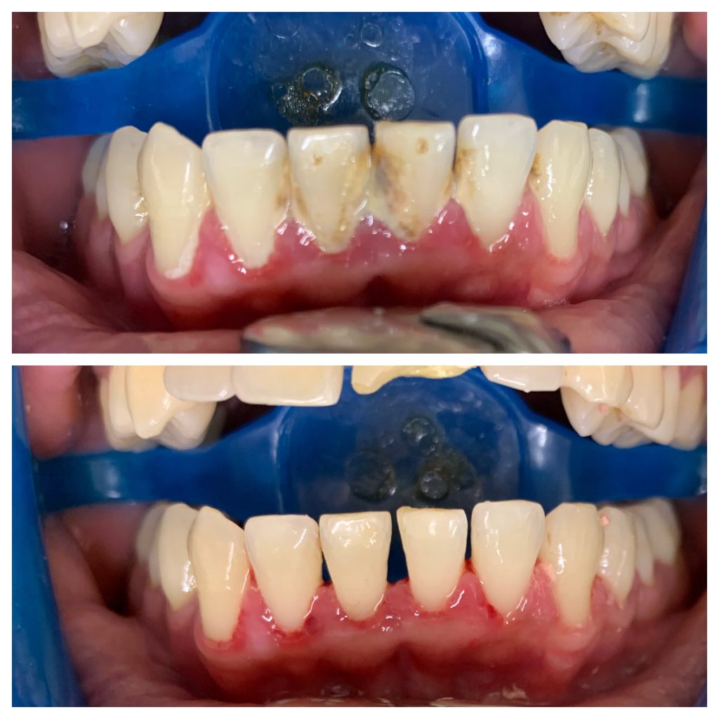 dental hygienist near me, London